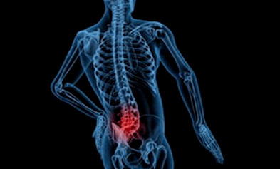 Die Gründe für die Entwicklung der lumbalen Osteochondrose