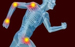 Die Gründe für die Entwicklung von Arthrotten und Arthrose